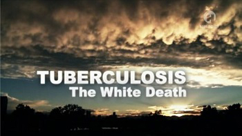 Туберкулёз: белая чума / Tuberсulosis: The White Death (2011)