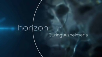 BBC horizon Лекарство от Альцгеймера (2016)